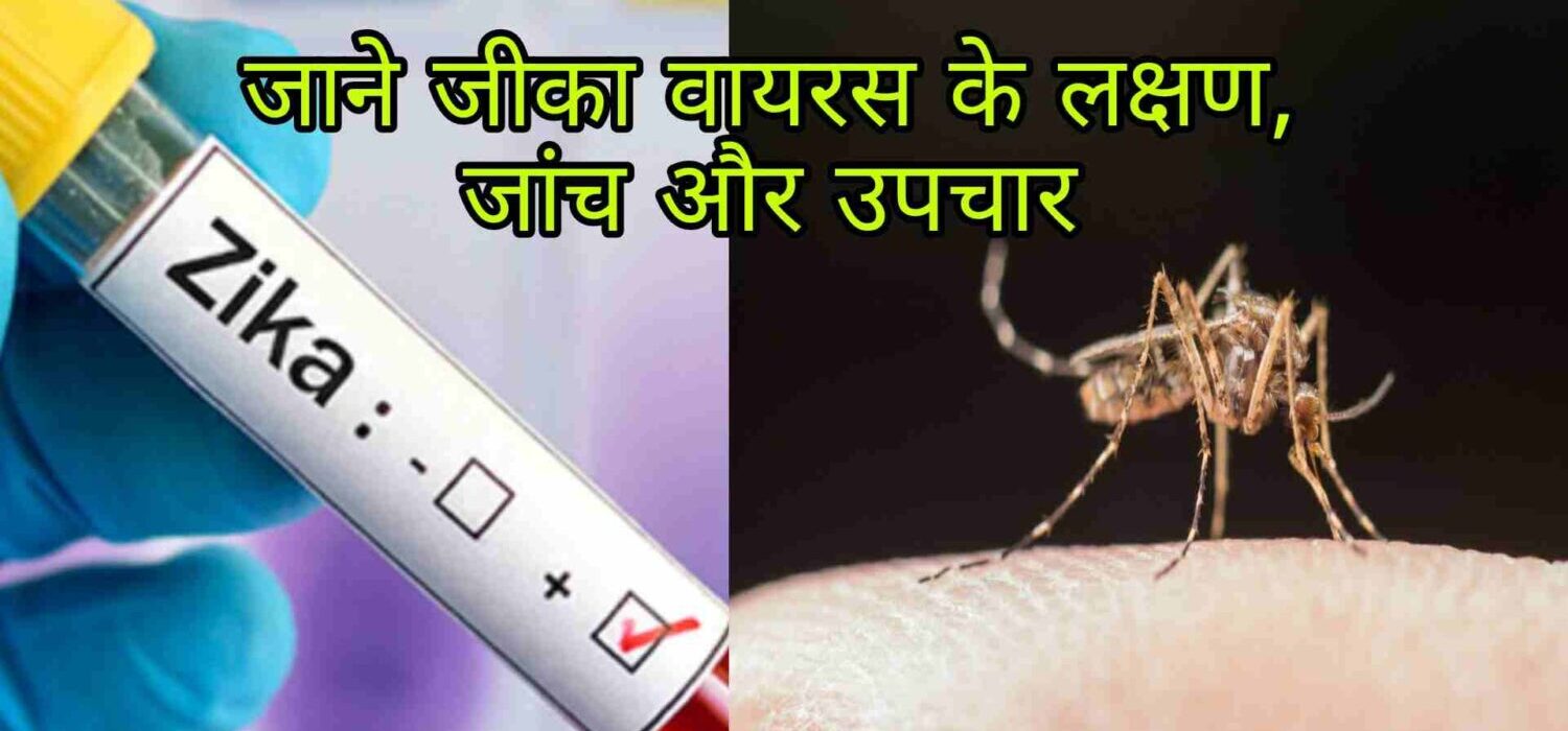 zika virus symptoms in hindi